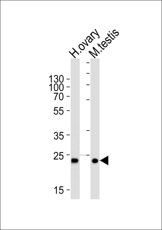Western blot of lysates from human ovary and mouse testis tissue lysates (from left to right), using PLD6 Antibody. Antibody was diluted at 1:1000 at each lane. A goat anti-rabbit IgG H&L (HRP) at 1:5000 dilution was used as the secondary antibody. Lysates at 35ug per lane.