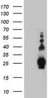 HEK293T cells were transfected with the pCMV6-ENTRY control (Left lane) or pCMV6-ENTRY PLDN (Right lane) cDNA for 48 hrs and lysed. Equivalent amounts of cell lysates (5 ug per lane) were separated by SDS-PAGE and immunoblotted with anti-PLDN.