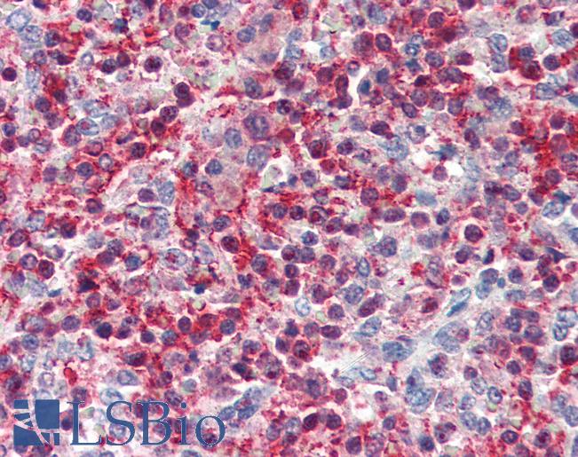 Anti-Pleckstrin antibody IHC of human spleen. Immunohistochemistry of formalin-fixed, paraffin-embedded tissue after heat-induced antigen retrieval. Antibody LS-B3236 concentration 75 ug/ml.