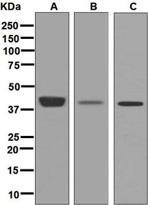 Western blot analysis on (A) human platelet, (B) HeLa, and (C) Raji lysates using anti-Pleckstrin antibody.