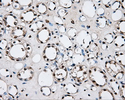IHC of paraffin-embedded Kidney tissue using anti-PLEK mouse monoclonal antibody. (Dilution 1:50).