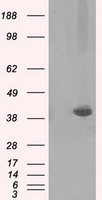 HEK293T cells were transfected with the pCMV6-ENTRY control (Left lane) or pCMV6-ENTRY PLEK (Right lane) cDNA for 48 hrs and lysed. Equivalent amounts of cell lysates (5 ug per lane) were separated by SDS-PAGE and immunoblotted with anti-PLEK.