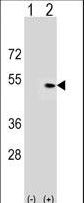 Western blot of PLEKHA1 (arrow) using rabbit polyclonal PLEKHA1 Antibody. 293 cell lysates (2 ug/lane) either nontransfected (Lane 1) or transiently transfected (Lane 2) with the PLEKHA1 gene.