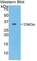 Western blot of recombinant PLEKHA1.