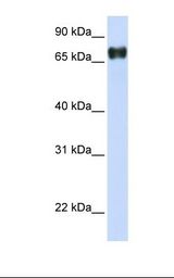 Transfected 293T cell lysate. Antibody concentration: 1.0 ug/ml. Gel concentration: 12%.