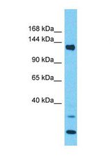 Western blot of Human NCI-H226. PLEKHA5 antibody dilution 1.0 ug/ml.