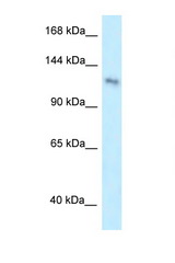PLEKHA7 antibody LS-C116538 Western blot of HepG2 Cell lysate. Antibody concentration 1 ug/ml.
