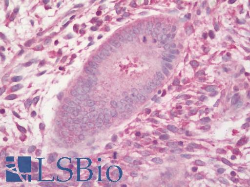 Human Uterus, Endometrium: Formalin-Fixed, Paraffin-Embedded (FFPE)