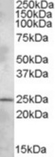 PLEKHB1 antibody (1 ug/ml) staining of Rat Brain lysate (35 ug protein/ml in RIPA buffer). Primary incubation was 1 hour. Detected by chemiluminescence.