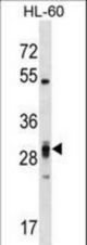 PLEKHF2 Antibody western blot of HL-60 cell line lysates (35 ug/lane). The PLEKHF2 antibody detected the PLEKHF2 protein (arrow).