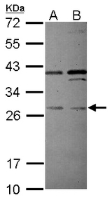 Sample (30 ug of whole cell lysate) A: Jurkat B: Raji 12% SDS PAGE PLEKHF2 antibody diluted at 1:500