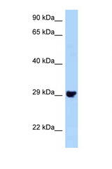 PLEKHF2 antibody LS-C146266 Western blot of Mouse Kidney lysate. Antibody concentration 1 ug/ml.