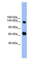PLEKHG2 antibody Western Blot of Fetal Heart.