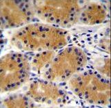 PLEKHG3 Antibody immunohistochemistry of formalin-fixed and paraffin-embedded human stomach tissue followed by peroxidase-conjugated secondary antibody and DAB staining.