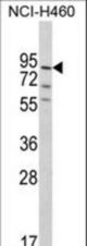 Western blot of MyoGEF Antibody in NCI-H460 cell line lysates (35 ug/lane). MyoGEF (arrow) was detected using the purified antibody.