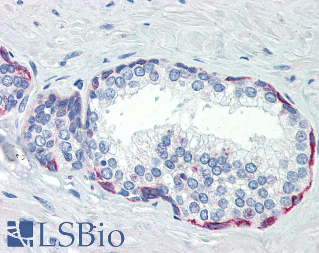 Anti-PLEKHH2 antibody IHC of human prostate. Immunohistochemistry of formalin-fixed, paraffin-embedded tissue after heat-induced antigen retrieval. Antibody LS-B3567 concentration 10 ug/ml.