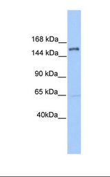 Jurkat cell lysate. Antibody concentration: 1.0 ug/ml. Gel concentration: 6-18%.