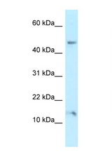 PLEKHJ1 antibody LS-C145961 Western blot of 721_B Cell lysate. Antibody concentration 1 ug/ml.