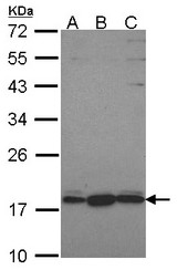 Sample (30 ug of whole cell lysate). A: Hela, B: JurKat, C: NT2D1. 12% SDS PAGE. GNRPX antibody. GNRPX / PLEKHJ1 antibody diluted at 1:1000.