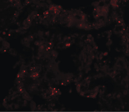 Immunofluorescence of PLKHM1 in human lung tissue with PLKHM1 antibody at 20 ug/ml.