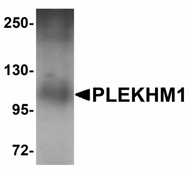 Western blot of PLEKHM1 in human lung tissue lysate with PLEKHM1 antibody at 1 ug/ml. Below: Immunohistochemistry of PLEKHM1 in human lung tissue with PLEKHM1 antibody at 5 ug/ml.