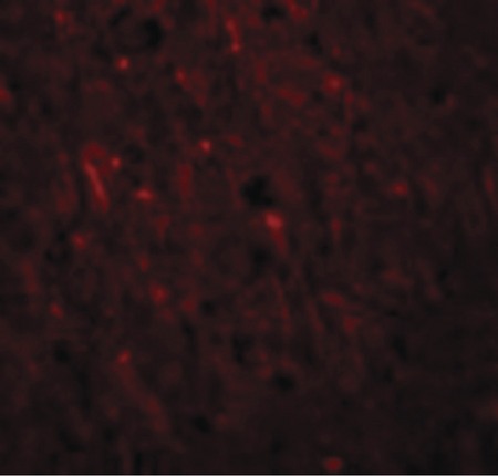 Immunofluorescence of PLEKHM2 in Human Brain cells with PLEKHM2 antibody at 20 ug/ml.