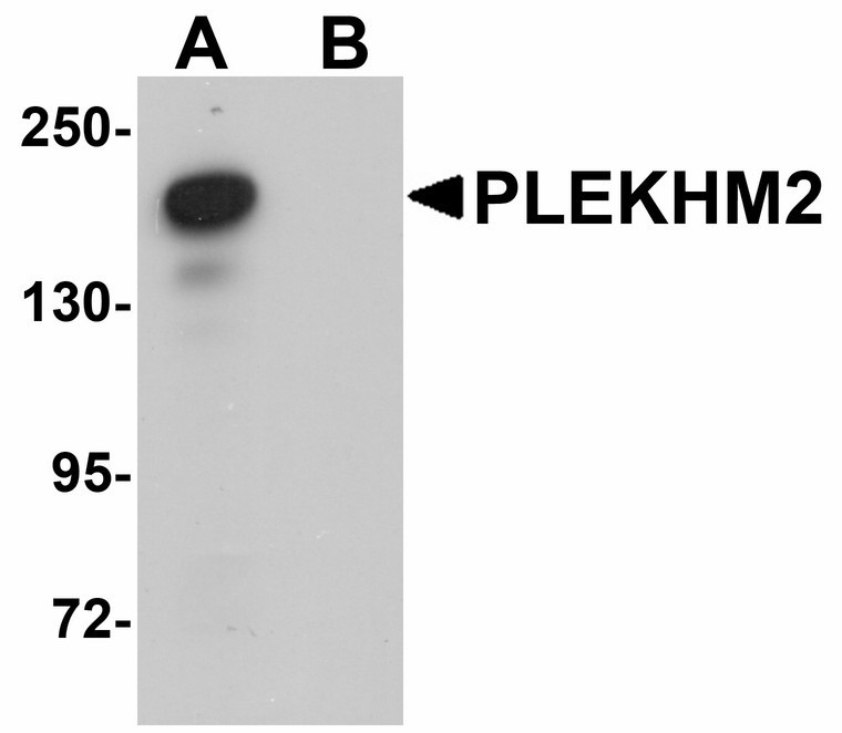 Western blot of PLEKHM2 in rat brain tissue lysate with PLEKHM2 antibody at 0.5 ug/ml in (A) the absence and (B) the presence of blocking peptide. Below: Immunohistochemistry of FAM59A in human liver tissue with FAM59A antibody at 5 ug/ml.