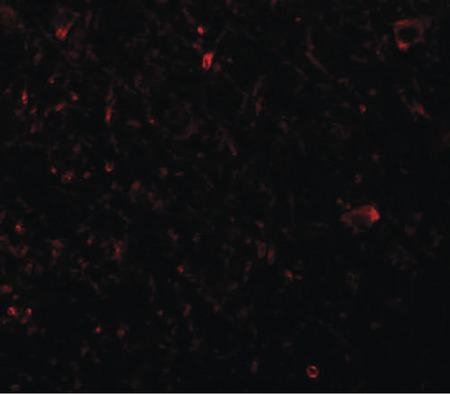 Immunofluorescence of PLKHM3 in human brain tissue with PLKHM3 antibody at 20 ug/ml.