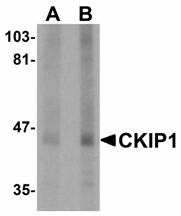 Western blot of CKIP1 in human lung tissue lysate with CKIP1 antibody at (A) 1 and (B) 2 ug/ml.
