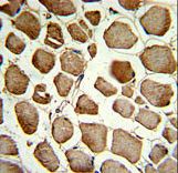 Formalin-fixed and paraffin-embedded human skeletal muscle reacted with CKIP-1 Antibody , which was peroxidase-conjugated to the secondary antibody, followed by DAB staining. This data demonstrates the use of this antibody for immunohistochemistry; clinical relevance has not been evaluated.
