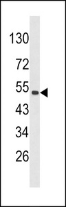 Western blot of CKIP-1 Antibody in 293 cell line lysates (35 ug/lane). CKIP-1 (arrow) was detected using the purified antibody.