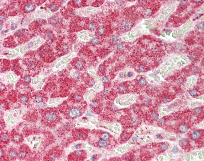 Human Liver: Formalin-Fixed, Paraffin-Embedded (FFPE)