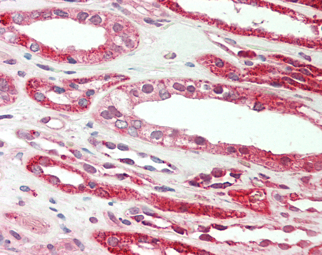 Human Kidney: Formalin-Fixed, Paraffin-Embedded (FFPE)