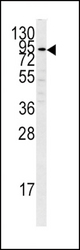 Western blot of PLG antibody in K562 cell line lysates (35 ug/lane). PLG (arrow) was detected using the purified antibody.