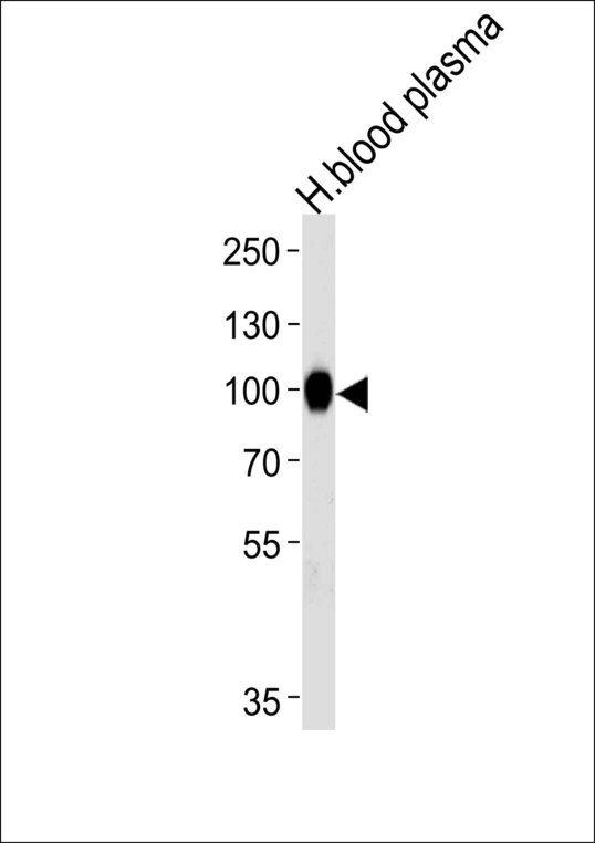 Western blot of lysate from human blood plasma tissue lysate, using PLG Antibody. Antibody was diluted at 1:1000 at each lane. A goat anti-rabbit IgG H&L (HRP) at 1:5000 dilution was used as the secondary antibody. Lysate at 35ug per lane.