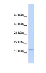 Fetal heart lysate. Antibody concentration: 1.0 ug/ml. Gel concentration: 1056-20%.