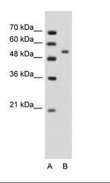 A: Marker, B: Jurkat Cell Lysate