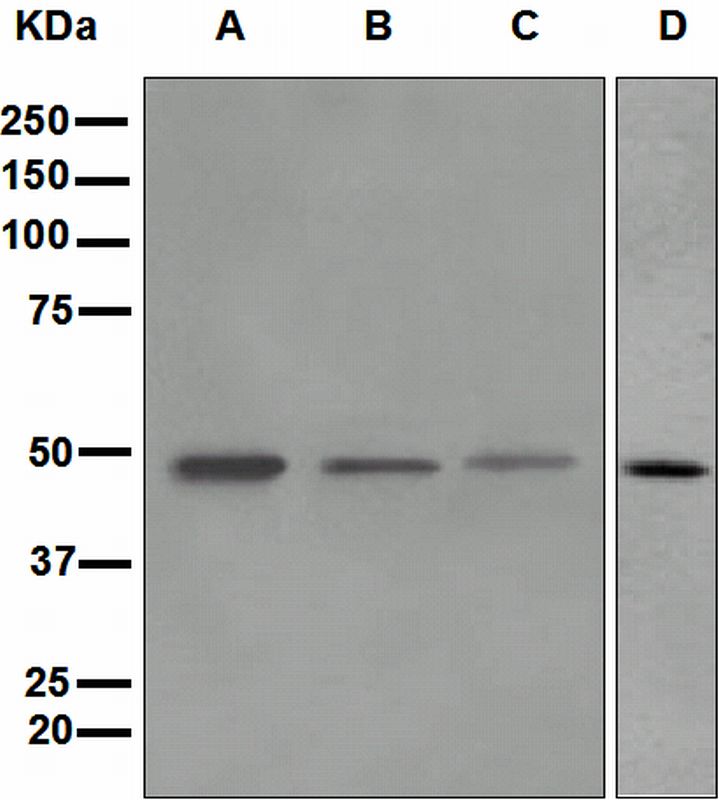 Western blot analysis on (A) fetal liver, (B) HepG2, (C) JAR, and (D) human milk lysates using anti-ADFP antibody.
