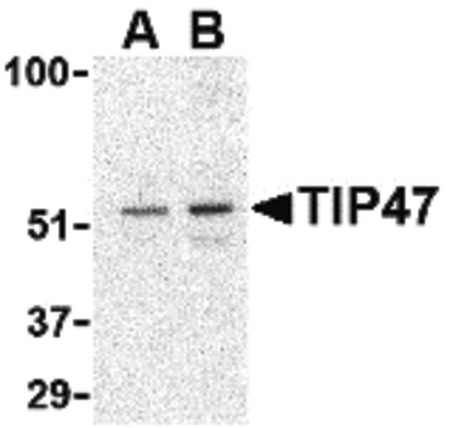 Western blot of TIP47 in Daudi cell lysate with TIP47 antibody at (A) 0.5 and (B) 1 ug/ml.
