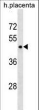 PLIN3 Antibody western blot of human placenta tissue lysates (35 ug/lane). The PLIN3 antibody detected the PLIN3 protein (arrow).