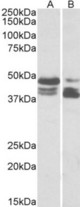 PLIN3 antibody (0.03 ug/ml) staining of HeLa (lane 1) and Human Colon cancer (lane two) lysate (35 ug protein in RIPA buffer). Primary incubation was 1 hour. Detected by chemiluminescence.