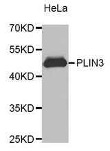 Western blot analysis of extracts of HeLa cell lines, using PLIN3 antibody.