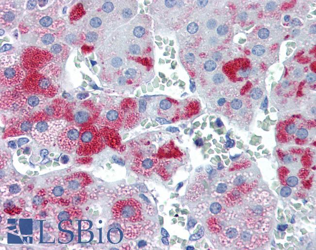 Anti-PLIN3 / M6PRBP1 antibody IHC of human adrenal. Immunohistochemistry of formalin-fixed, paraffin-embedded tissue after heat-induced antigen retrieval. Antibody LS-B2539 concentration 5 ug/ml.