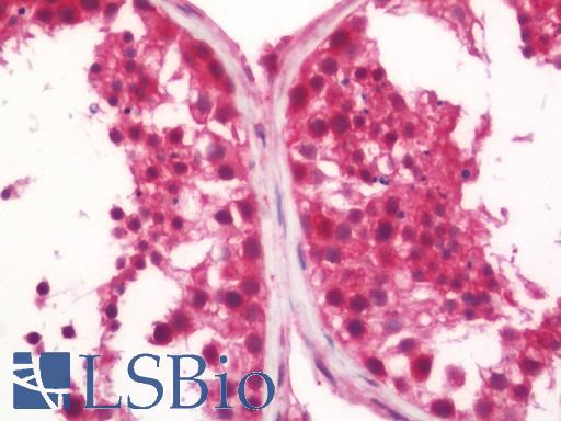 Human Testis: Formalin-Fixed, Paraffin-Embedded (FFPE)