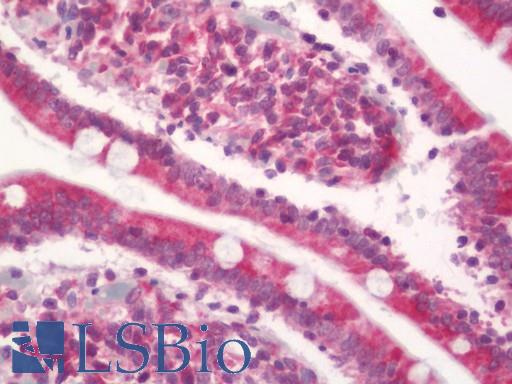 Human Small Intestine: Formalin-Fixed, Paraffin-Embedded (FFPE)