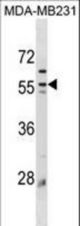 Mouse Plin3 Antibody western blot of MDA-MB231 cell line lysates (35 ug/lane). The Mouse Plin3 antibody detected the Mouse Plin3 protein (arrow).