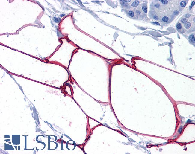 Anti-PLIN4 / KIAA1881 antibody IHC of human adipocytes. Immunohistochemistry of formalin-fixed, paraffin-embedded tissue after heat-induced antigen retrieval. Antibody LS-B4936 concentration 3.75 ug/ml.