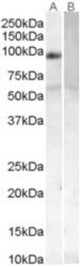 Antibody (0.1 ug/ml) staining of Human Placenta lysate (35 ug protein in RIPA buffer) with (B) and without (A) blocking with the immunizing peptide. Primary incubation was 1 hour. Detected by chemiluminescence.