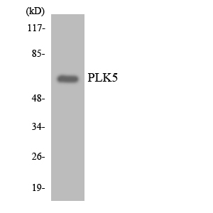 Western blot of the lysates from HeLa cells using PLK5 antibody.