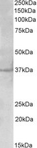 PLK5 antibody (2 ug/ml) staining of Cerebral Cortex lysate (35 ug protein in RIPA buffer). Primary incubation was 1 hour. Detected by chemiluminescence.